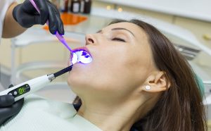 Conscious Sedation Dentistry in Bedford TX Area 