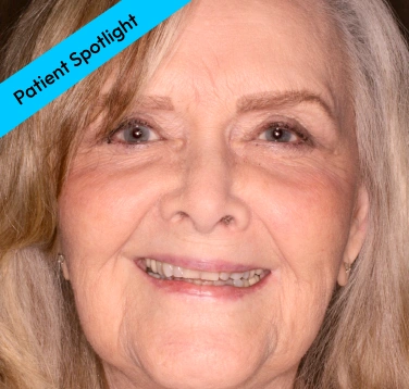 Patient Spotlight - Before Smile Transformation