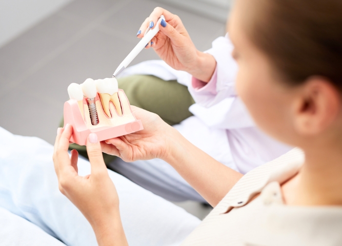 dental implants for your missing teeth