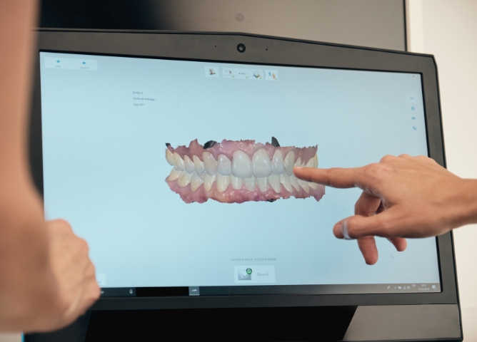 Can Tooth-Colored Fillings Fix Chipped or Cracked Teeth