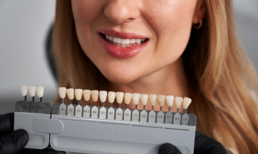 professional veneers in bedford